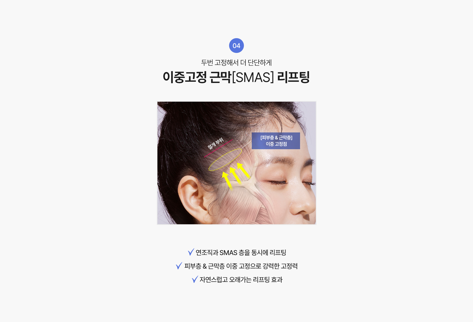 4. 두번 고정해서 더 단단하게
이중고정 근막[SMAS] 리프팅
√ 연조직과 SMAS 층을 동시에 리프팅
√ 피부층&근막층 이중 고정으로 강력한 고정력
√ 자연스럽고 오래가는 리프팅 효과


