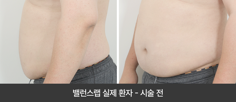 관리