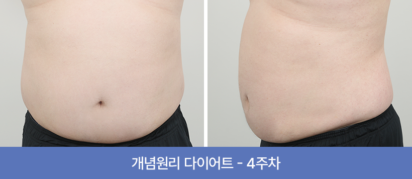 관리