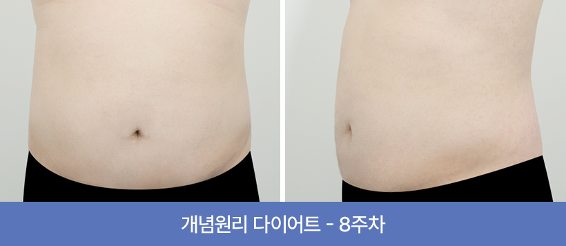 관리
