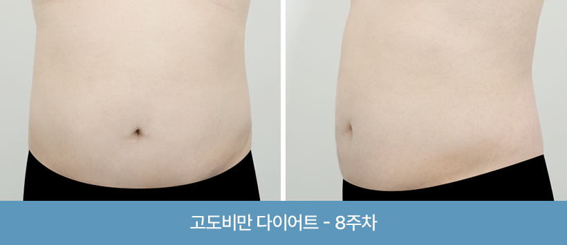 관리